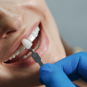 Dental Implant